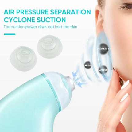 Mini Handheld Vacuum Blackhead Remover â€“ Facial Massage & Spot Lifting (1 Pc)