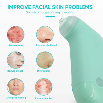 Mini Handheld Vacuum Blackhead Remover â€“ Facial Massage & Spot Lifting (1 Pc)