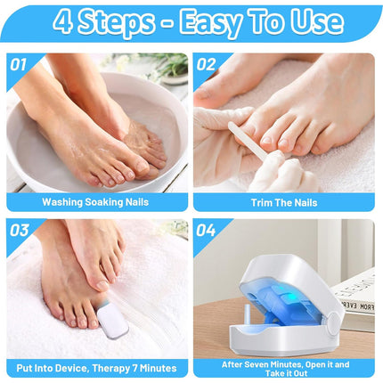 Rechargeable Nail Fungus Laser â€“ Anti-Fungal Device for Toenails, Hands & Feet (Home Use)