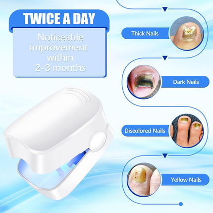 Rechargeable Nail Fungus Laser â€“ Anti-Fungal Device for Toenails, Hands & Feet (Home Use)